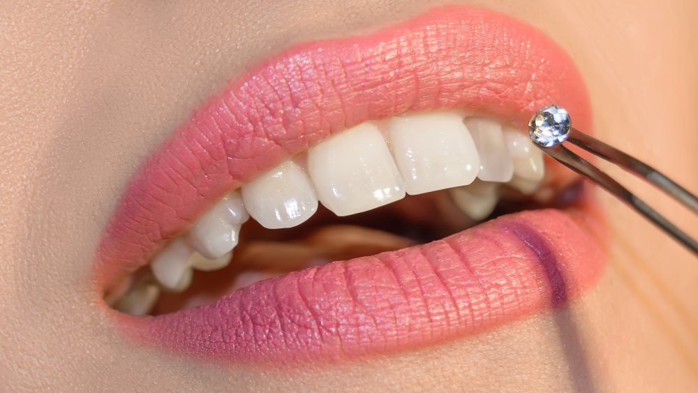 Can You Use Tooth Gems Without Harming Your Teeth? - Angel Care Dental